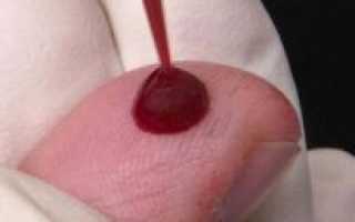 Плохая сворачиваемость крови причины и лечение