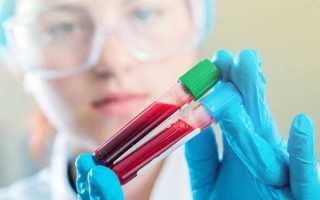 Повышен уровень лейкоцитов в крови причины