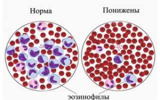 Повышенные эозинофилы в крови что это значит