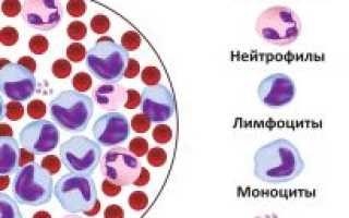 Лейкоз симптомы у взрослых анализ крови прогноз
