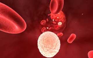 Лейкоциты в крови понижены причины у женщин