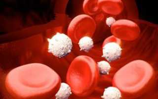 Лейкоцитоз в крови причины лечение у женщин