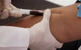 Повышение прямого билирубина в крови у ребенка