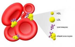 Повышенные триглицериды и холестерин в крови