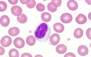Повышенный уровень лимфоцитов в крови у мужчин