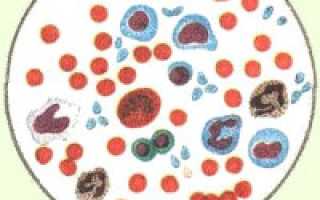 Повышенный уровень лейкоцитов в крови у мужчин