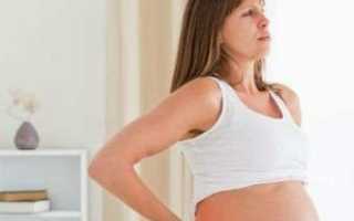 Межреберная невралгия во время беременности
